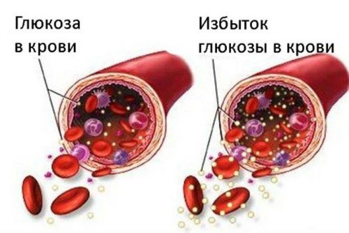 Глюкоза в крови